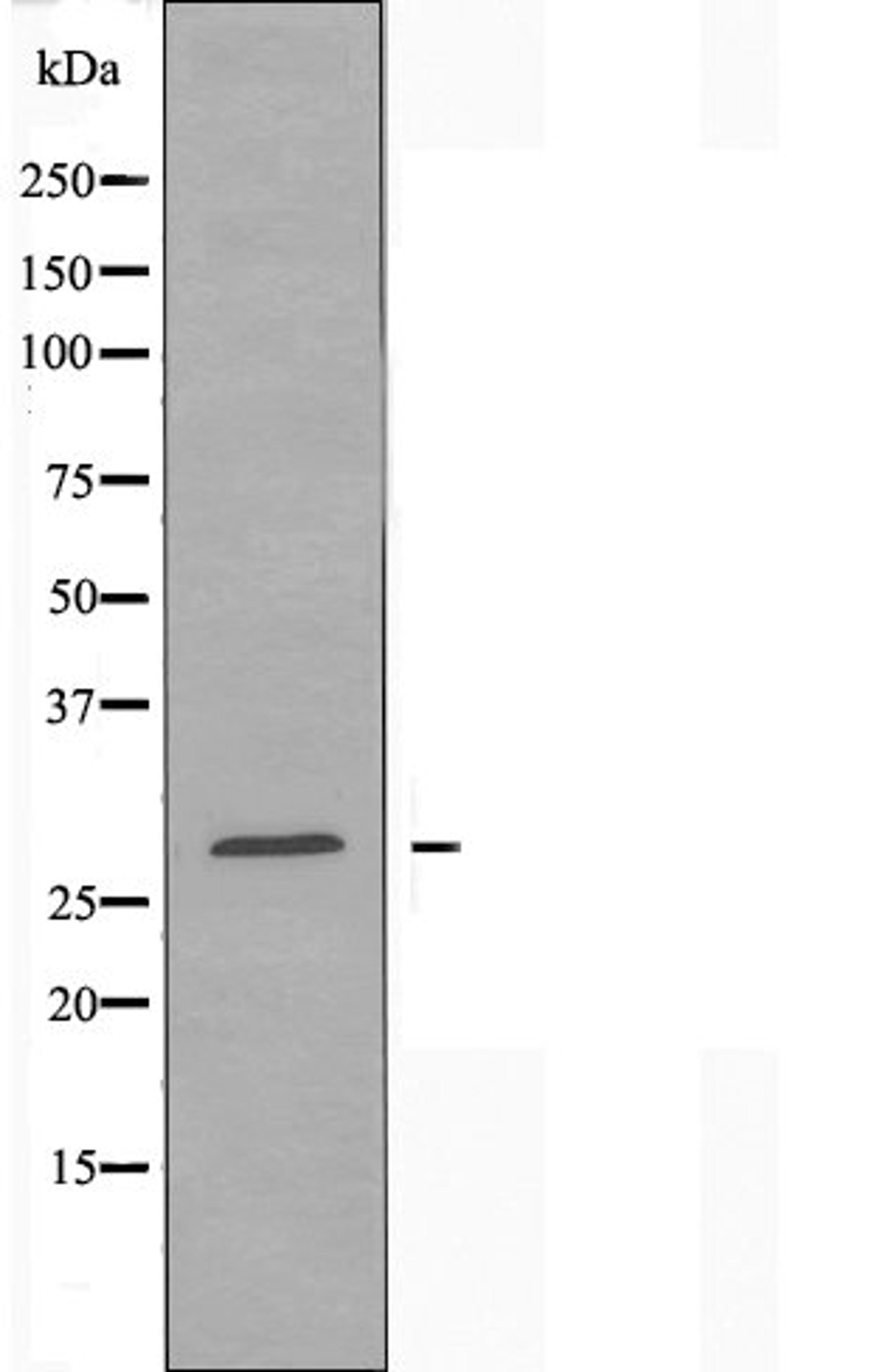 Western blot analysis of HepG2 cells using RPL7L1 antibody