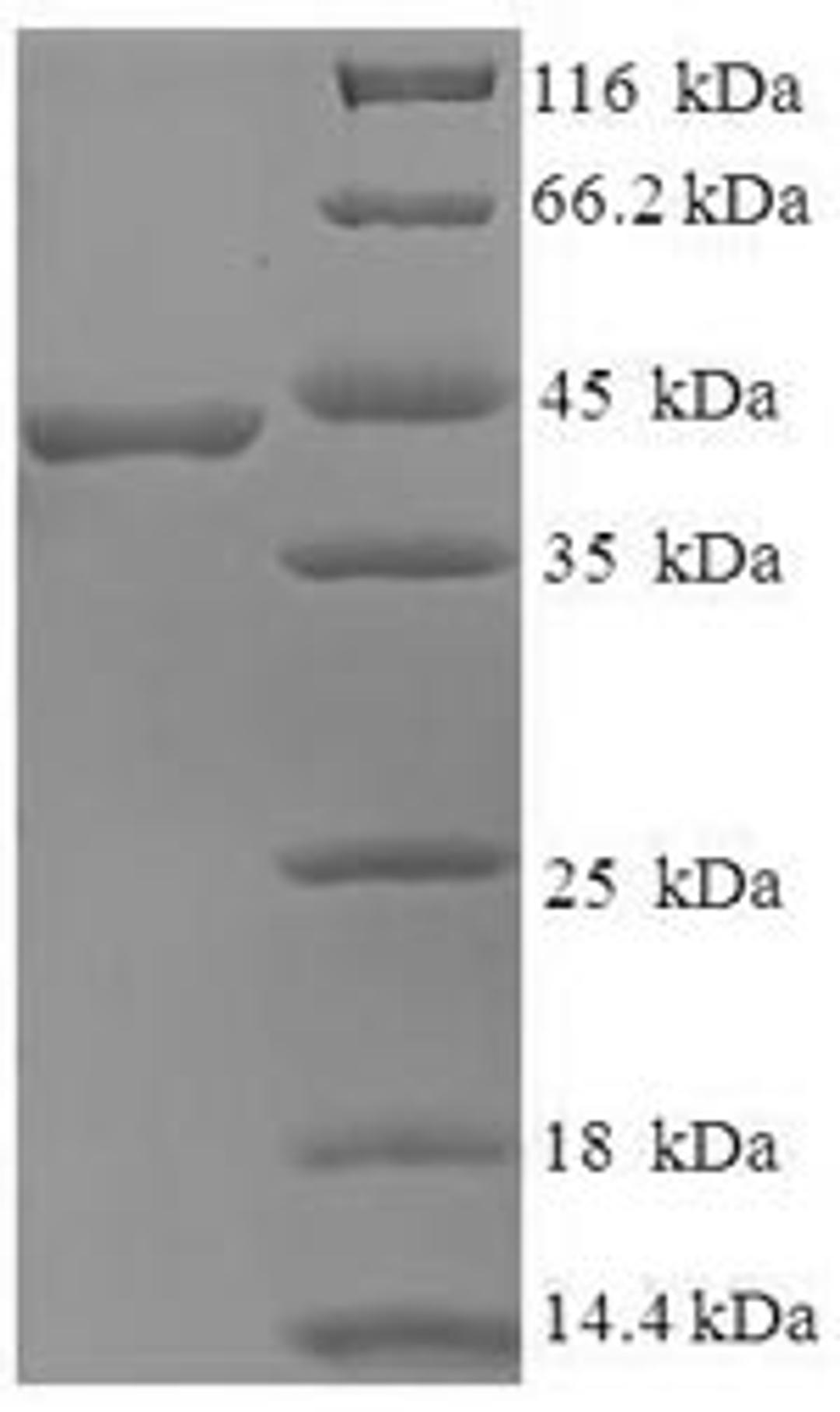 (Tris-Glycine gel) Discontinuous SDS-PAGE (reduced) with 5% enrichment gel and 15% separation gel.