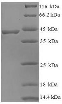 (Tris-Glycine gel) Discontinuous SDS-PAGE (reduced) with 5% enrichment gel and 15% separation gel.