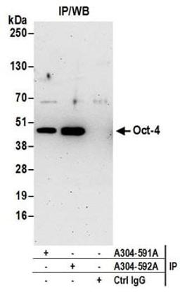 Detection of mouse Oct-4 by western blot of immunoprecipitates.