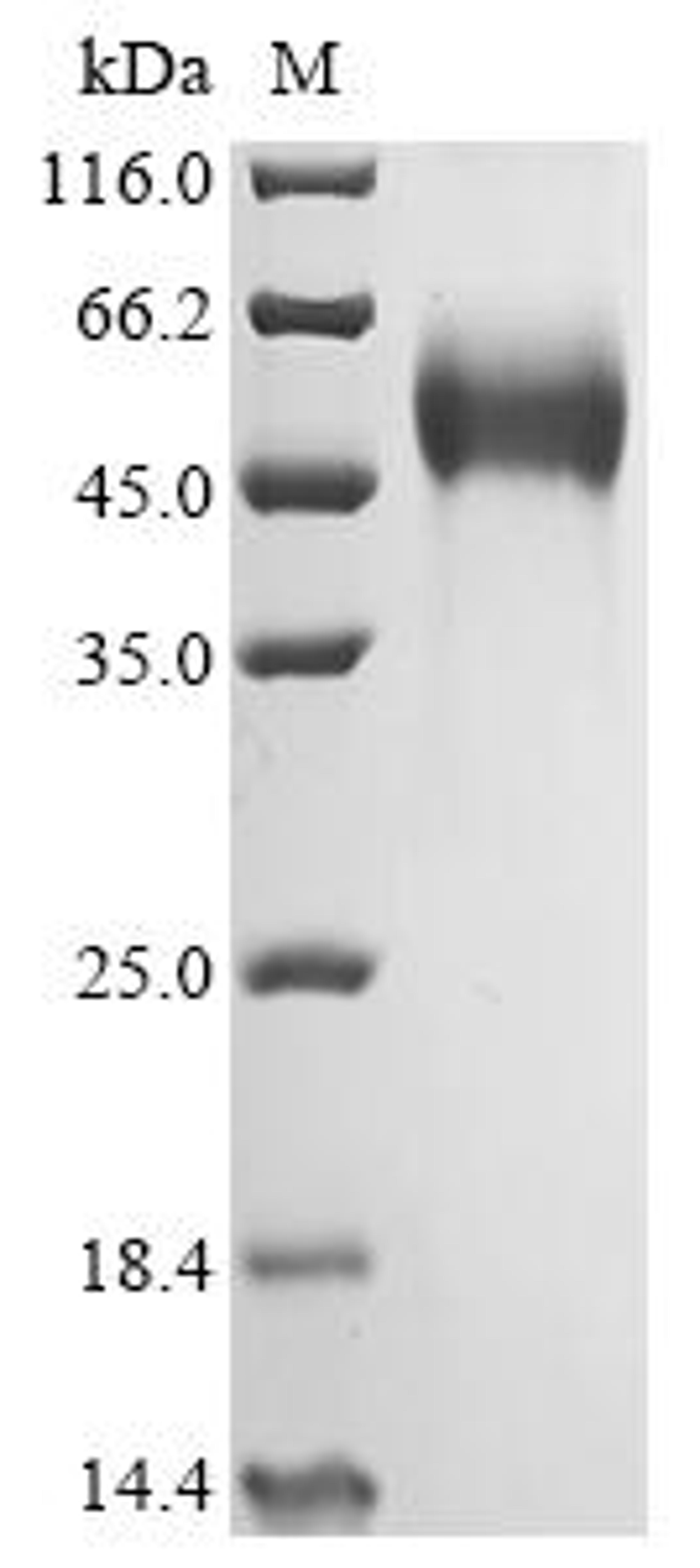 (Tris-Glycine gel) Discontinuous SDS-PAGE (reduced) with 5% enrichment gel and 15% separation gel.