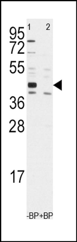 Western blot analysis of anti-ALDH1A3 Antibody pre-incubated with and without blocking peptide in Jurkat cell line lysate