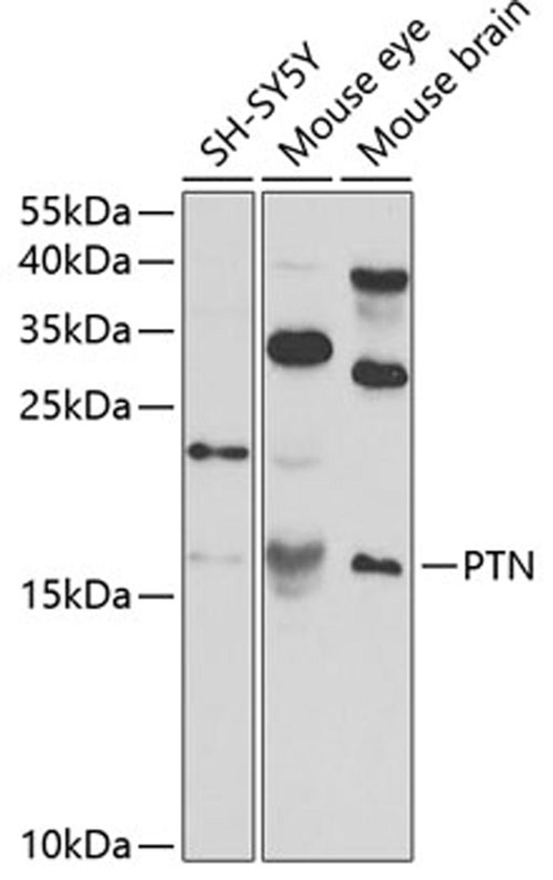 Western blot - PTN antibody (A3124)