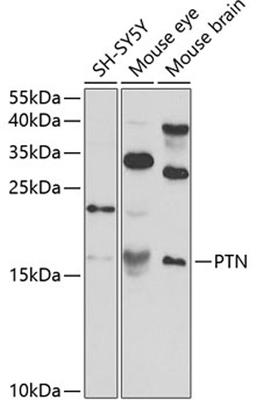 Western blot - PTN antibody (A3124)
