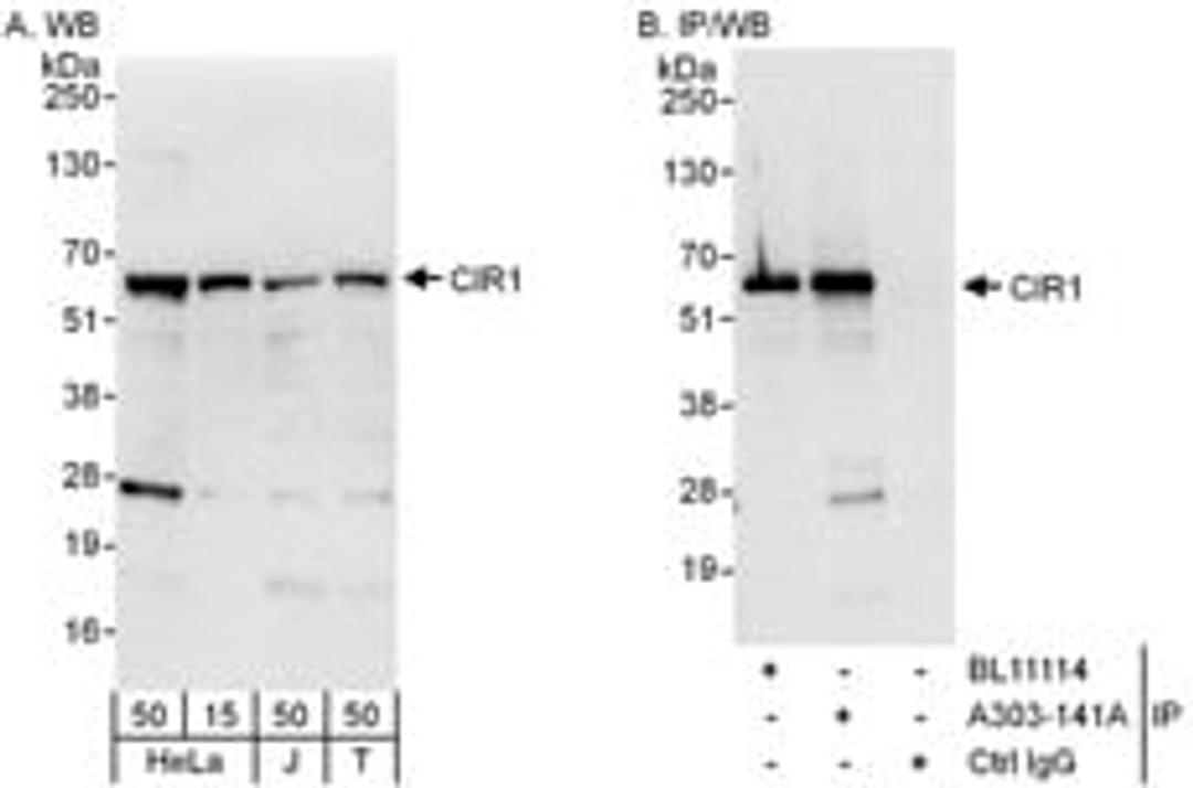 Detection of human CIR1 by western blot and immunoprecipitation.