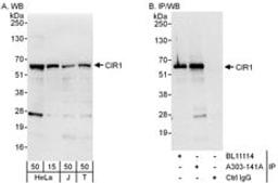 Detection of human CIR1 by western blot and immunoprecipitation.