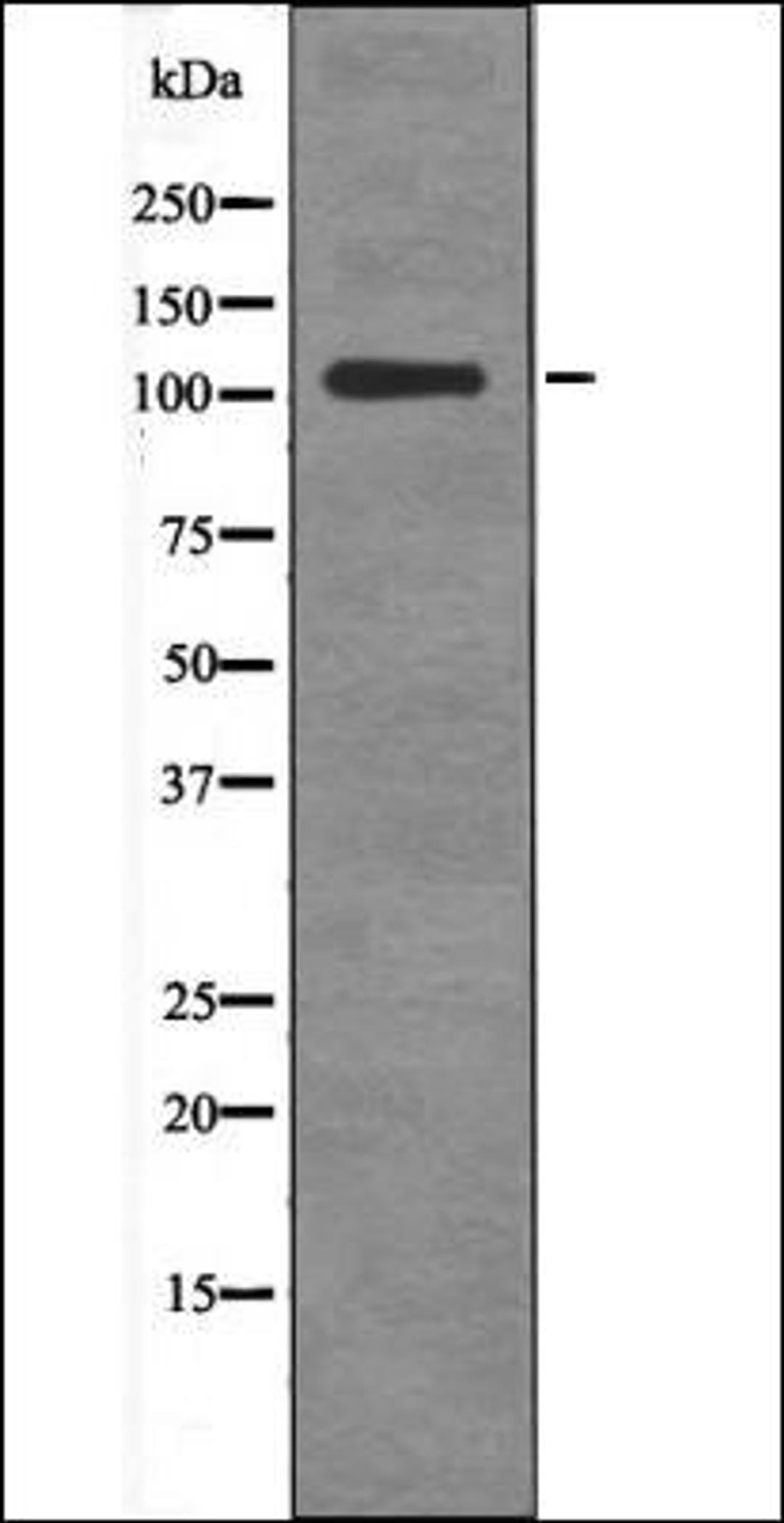 Western blot analysis of HeLa whole cell lysates using BCLAF1 -Phospho-Ser531- antibody