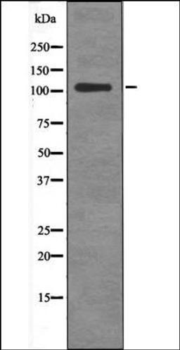 Western blot analysis of HeLa whole cell lysates using BCLAF1 -Phospho-Ser531- antibody