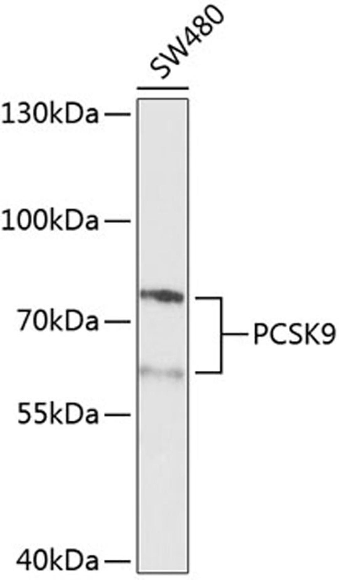 Western blot - PCSK9 Antibody (A7860)