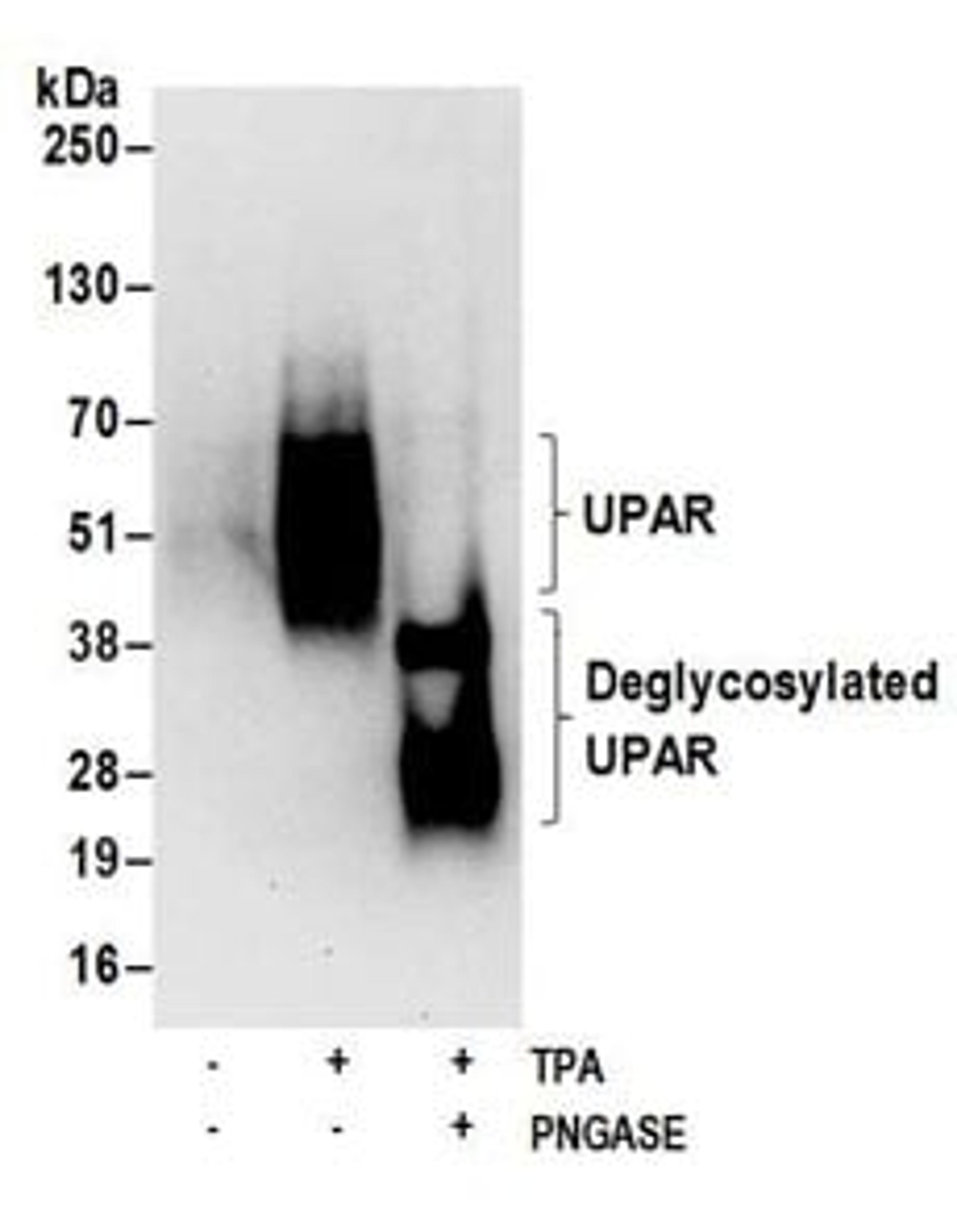 Detection of human glycosylated and deglycosylated UPAR by western blot.