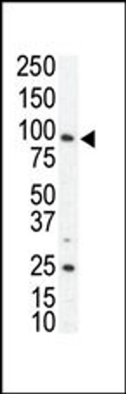 Western blot analysis of anti-AXL N-term Pab in SKBR3 cell lysate