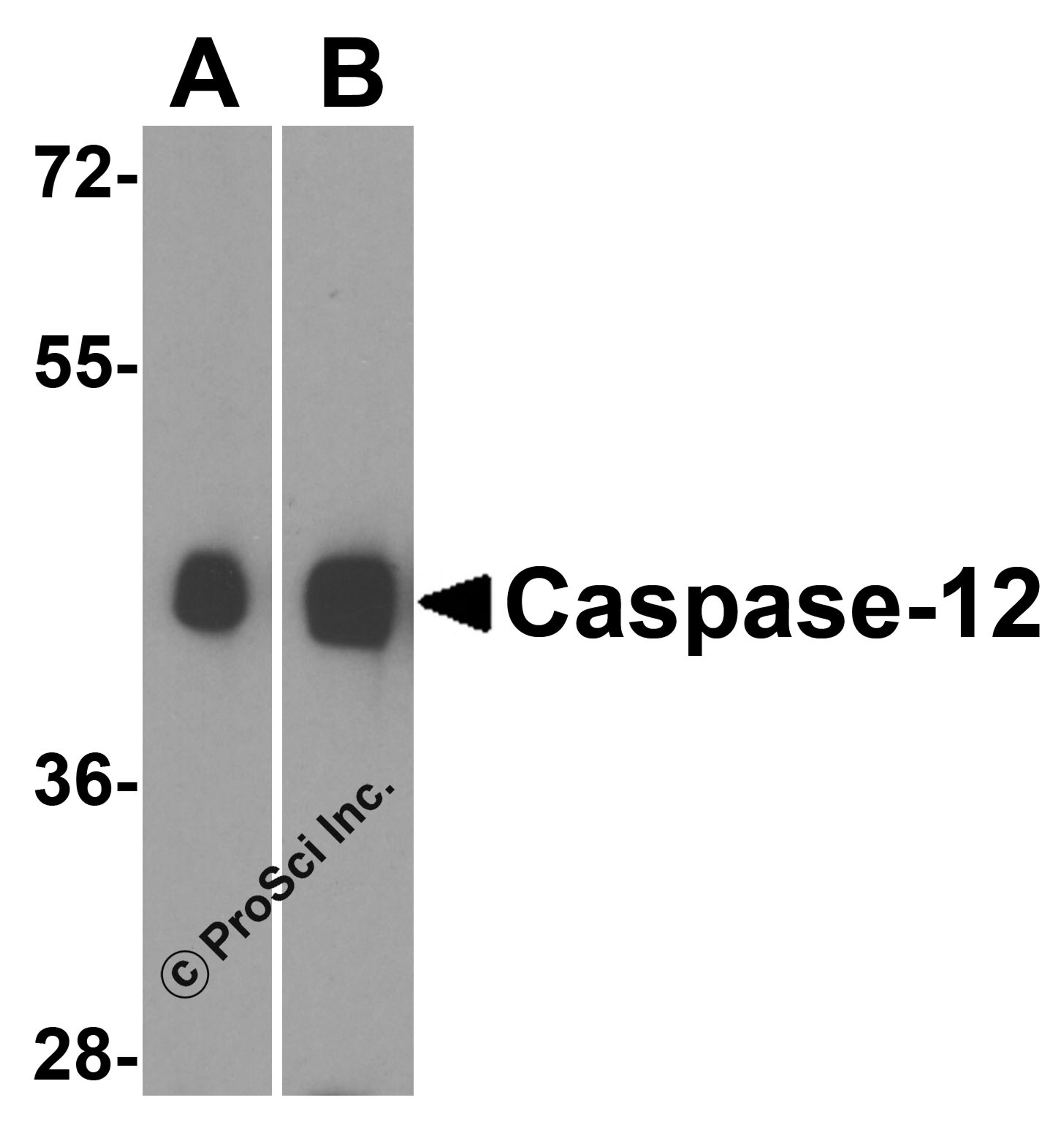 Western blot analysis of caspase-12 in (A) human and (B) mouse heart lysate with caspase-12 antibody at 0.5 μg/mL.
