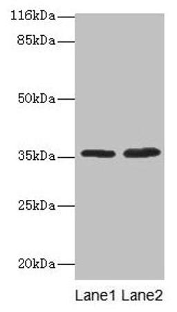 Western blot. All lanes: ACKR1 antibody at 2µg/ml. Lane 1: Mouse kidney tissue. Lane 2: Mouse spleen tissue. Secondary. Goat polyclonal to rabbit IgG at 1/10000 dilution. Predicted band size: 36 kDa. Observed band size: 36 kDa