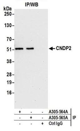 Detection of human CNDP2 by western blot of immunoprecipitates.