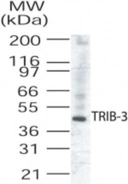 Western Blot: TRIB3 Antibody [NB100-56398] - Analysis of TRIB3 in human liver lysate.