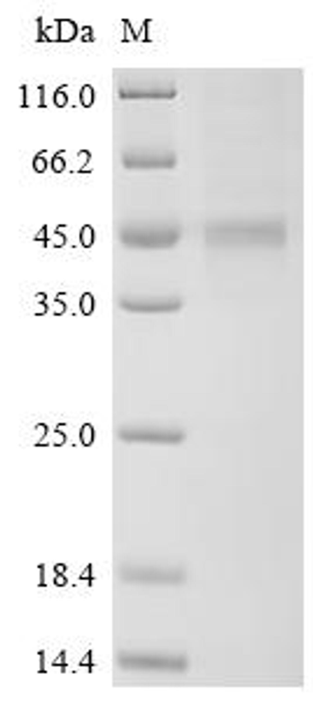 (Tris-Glycine gel) Discontinuous SDS-PAGE (reduced) with 5% enrichment gel and 15% separation gel.