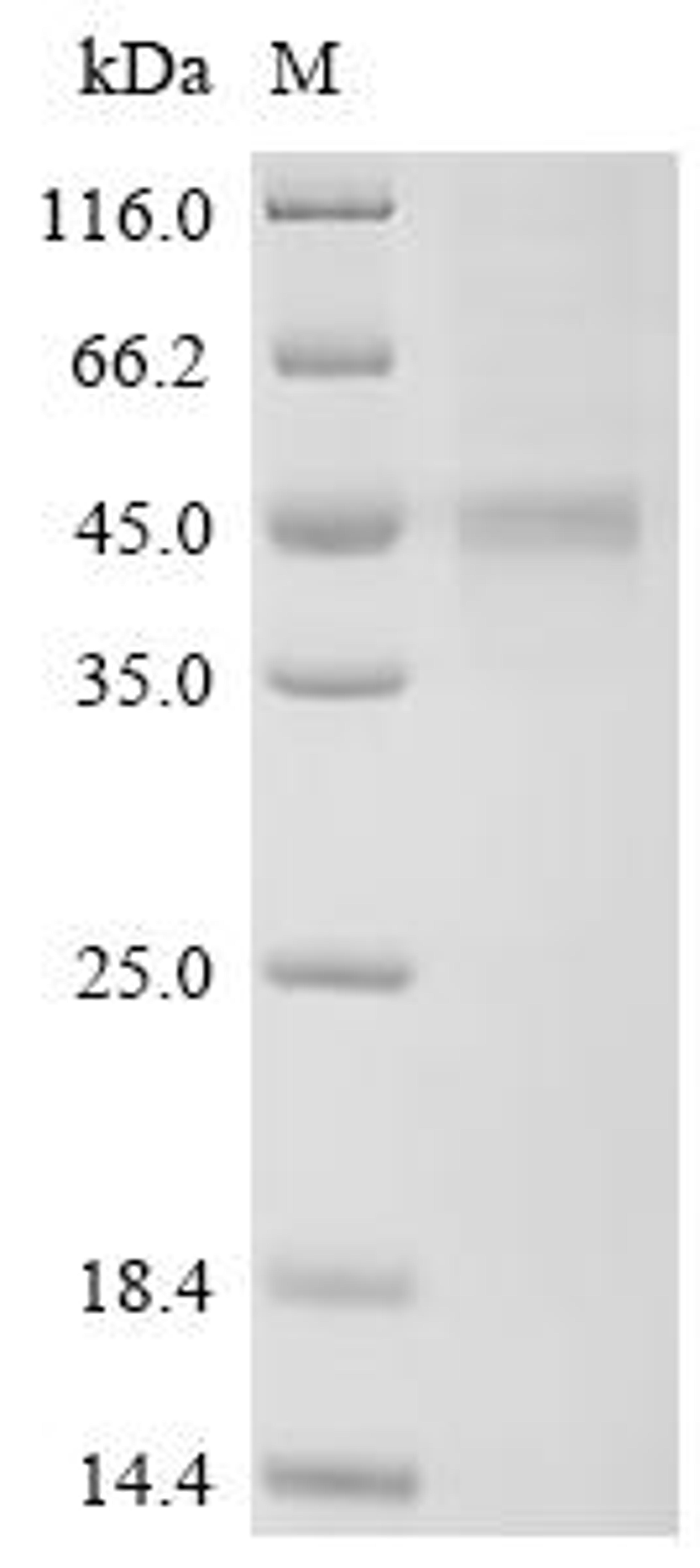 (Tris-Glycine gel) Discontinuous SDS-PAGE (reduced) with 5% enrichment gel and 15% separation gel.