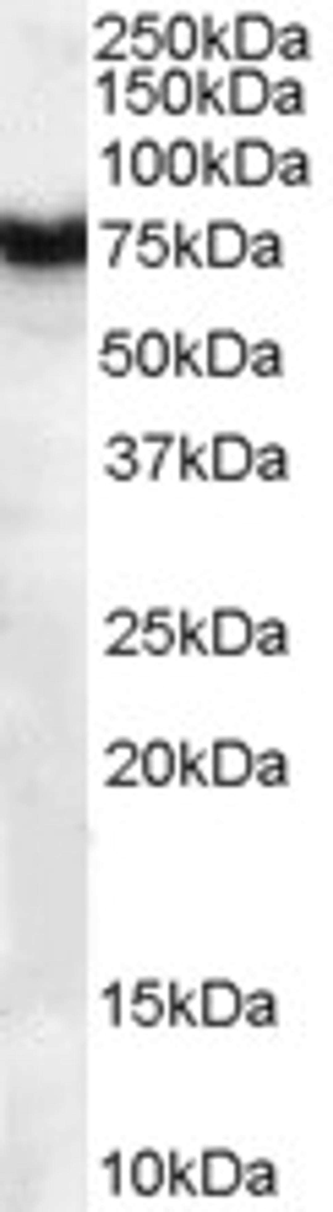 45-636 (1ug/ml) staining of Human Pancreas lysate (35ug protein in RIPA buffer). Primary incubation was 1 hour. Detected by chemiluminescence.