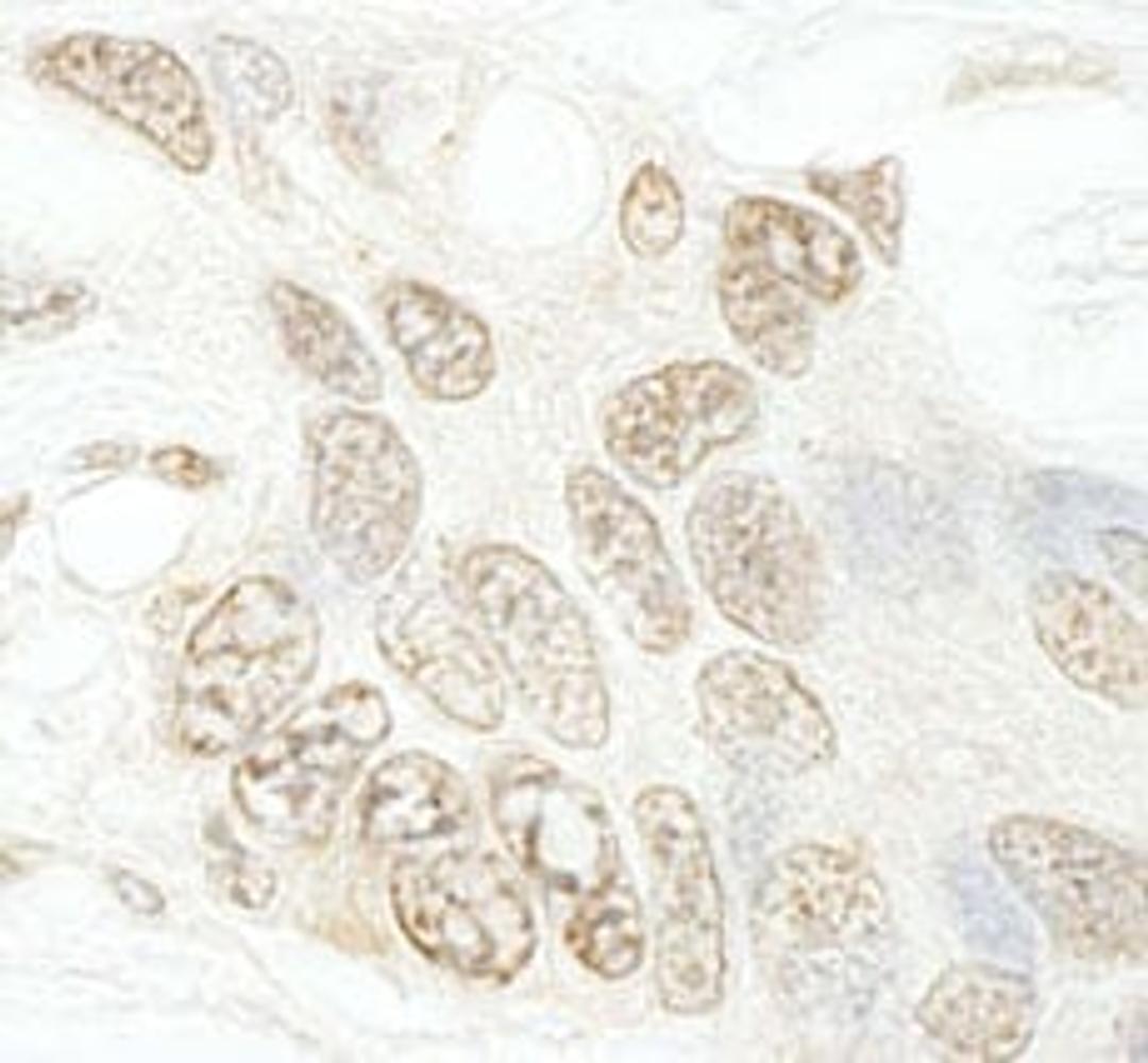 Detection of human hSET1B by immunohistochemistry.