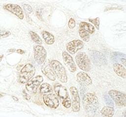 Detection of human hSET1B by immunohistochemistry.