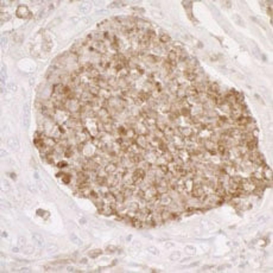 Detection of human ANXA1 by immunohistochemistry.