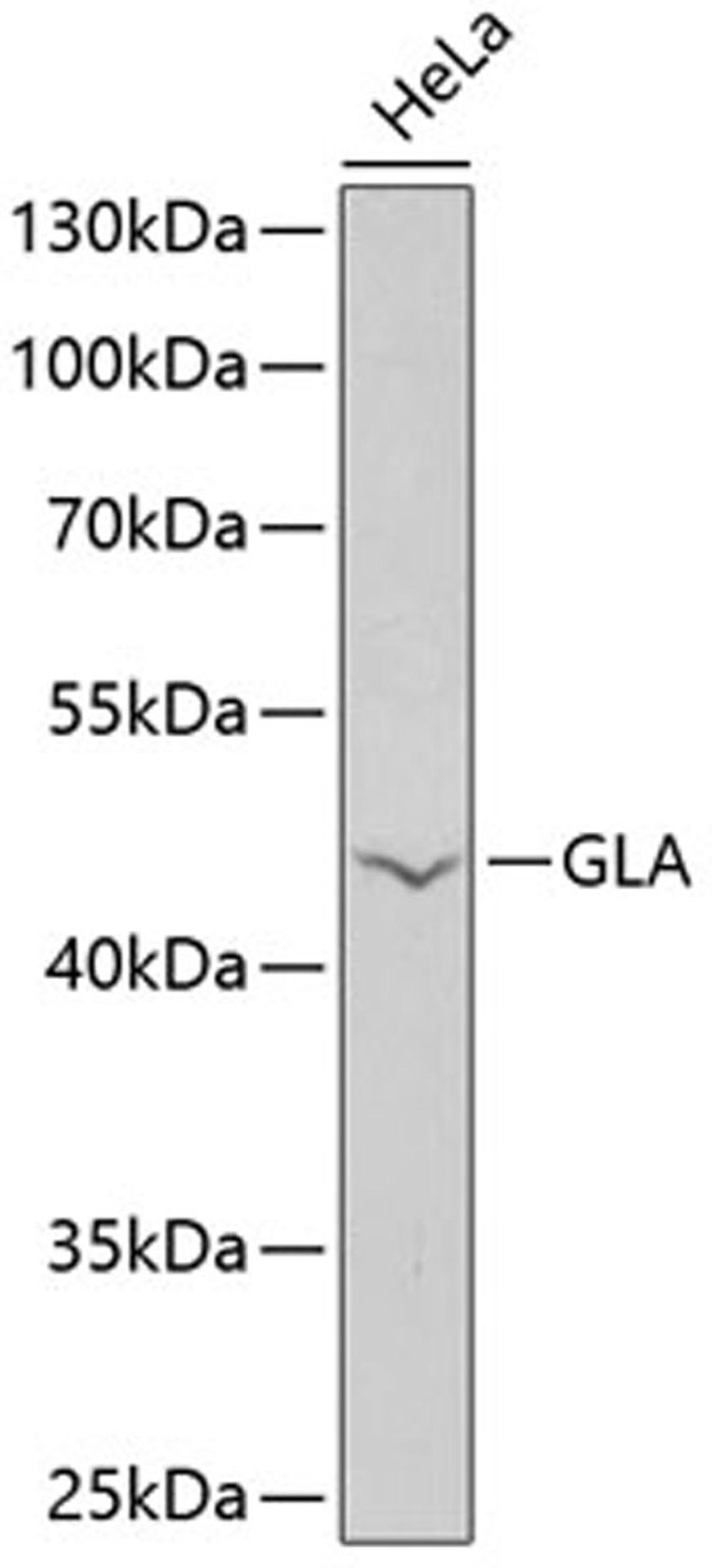 Western blot - GLA antibody (A13987)