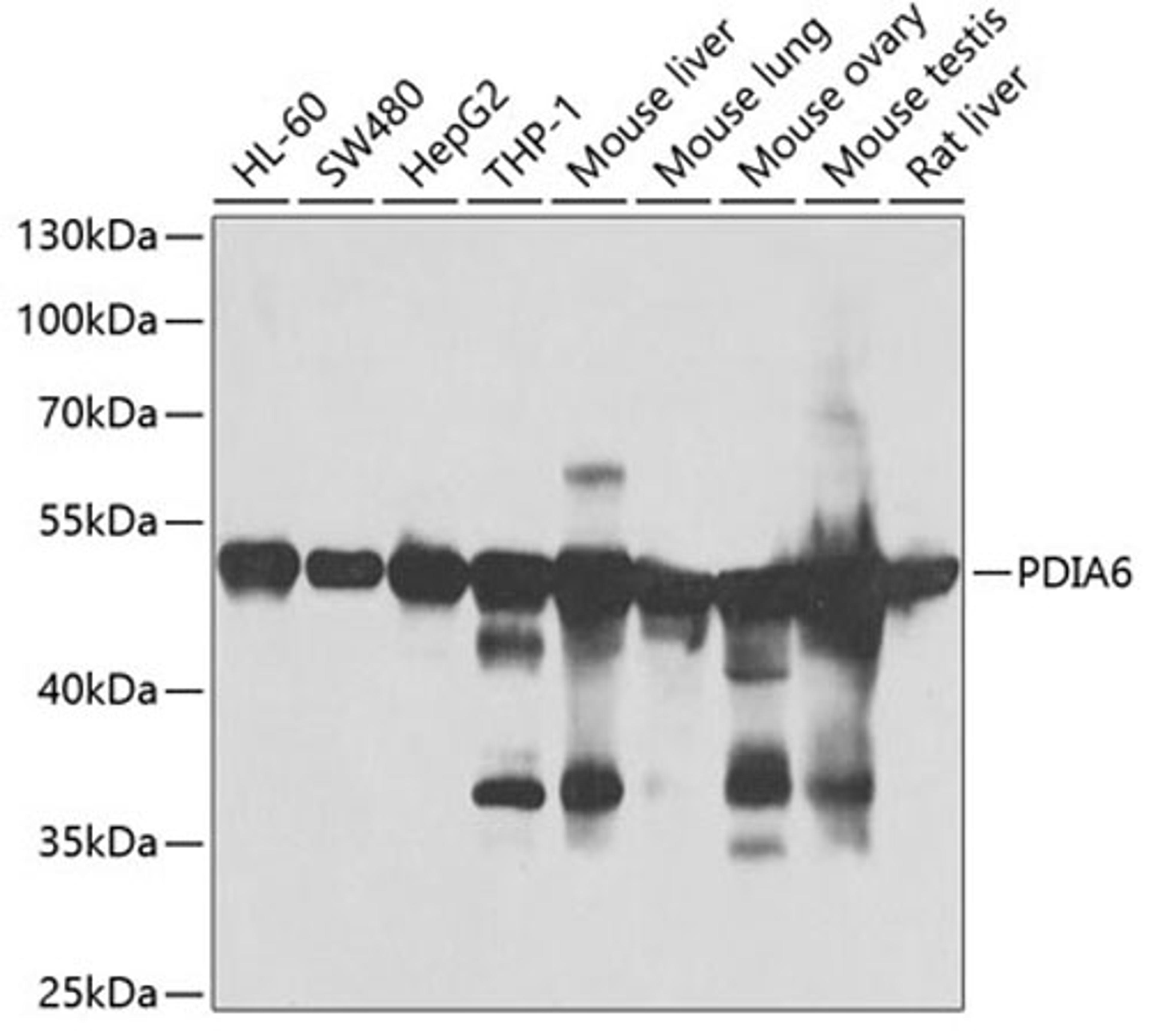 Western blot - PDIA6 antibody (A7055)