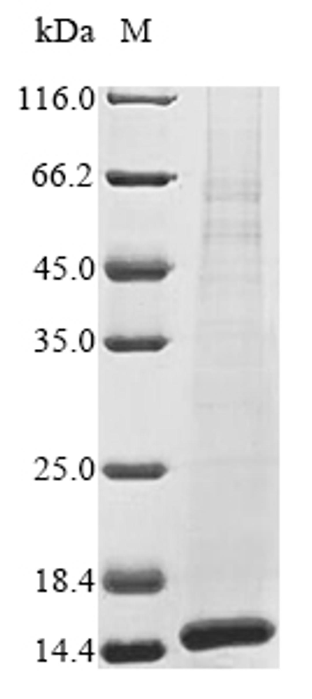 (Tris-Glycine gel) Discontinuous SDS-PAGE (reduced) with 5% enrichment gel and 15% separation gel.