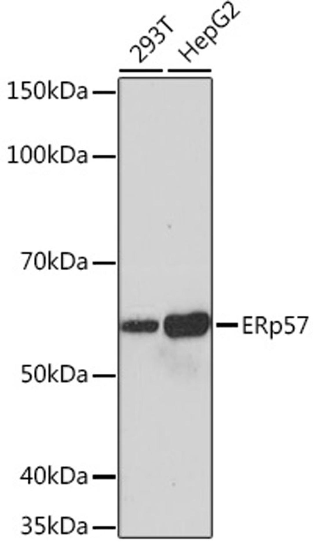 Western blot - ERp57 Rabbit mAb (A4376)