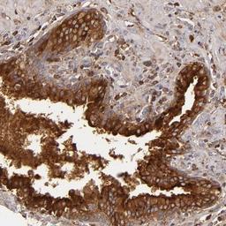 Immunohistochemistry-Paraffin: Complement Factor B Antibody [NBP1-89985] - Staining of human prostate shows strong cytoplasmic and membranous positivity in glandular cells.