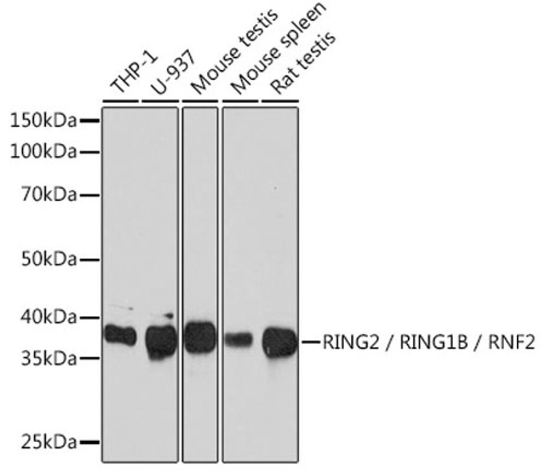 Western blot - RING2 / RING1B / RNF2 Rabbit mAb (A3564)