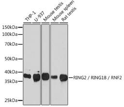 Western blot - RING2 / RING1B / RNF2 Rabbit mAb (A3564)