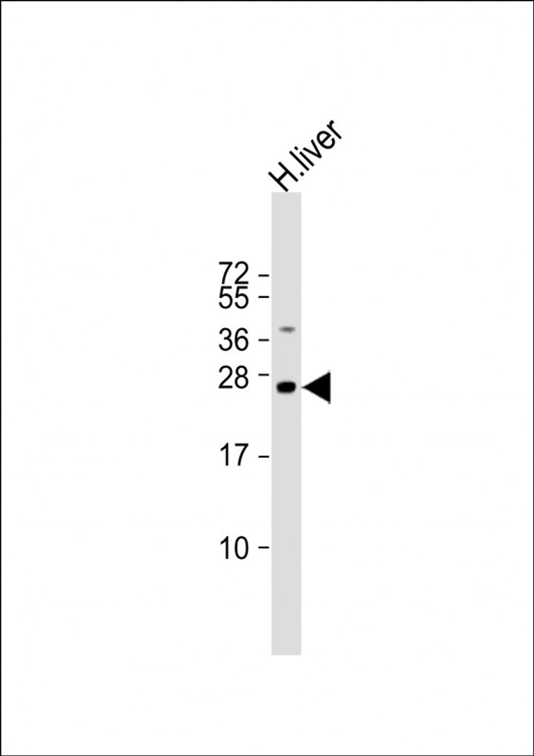 Western Blot at 1:2000 dilution + human liver lysate Lysates/proteins at 20 ug per lane.