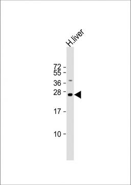 Western Blot at 1:2000 dilution + human liver lysate Lysates/proteins at 20 ug per lane.