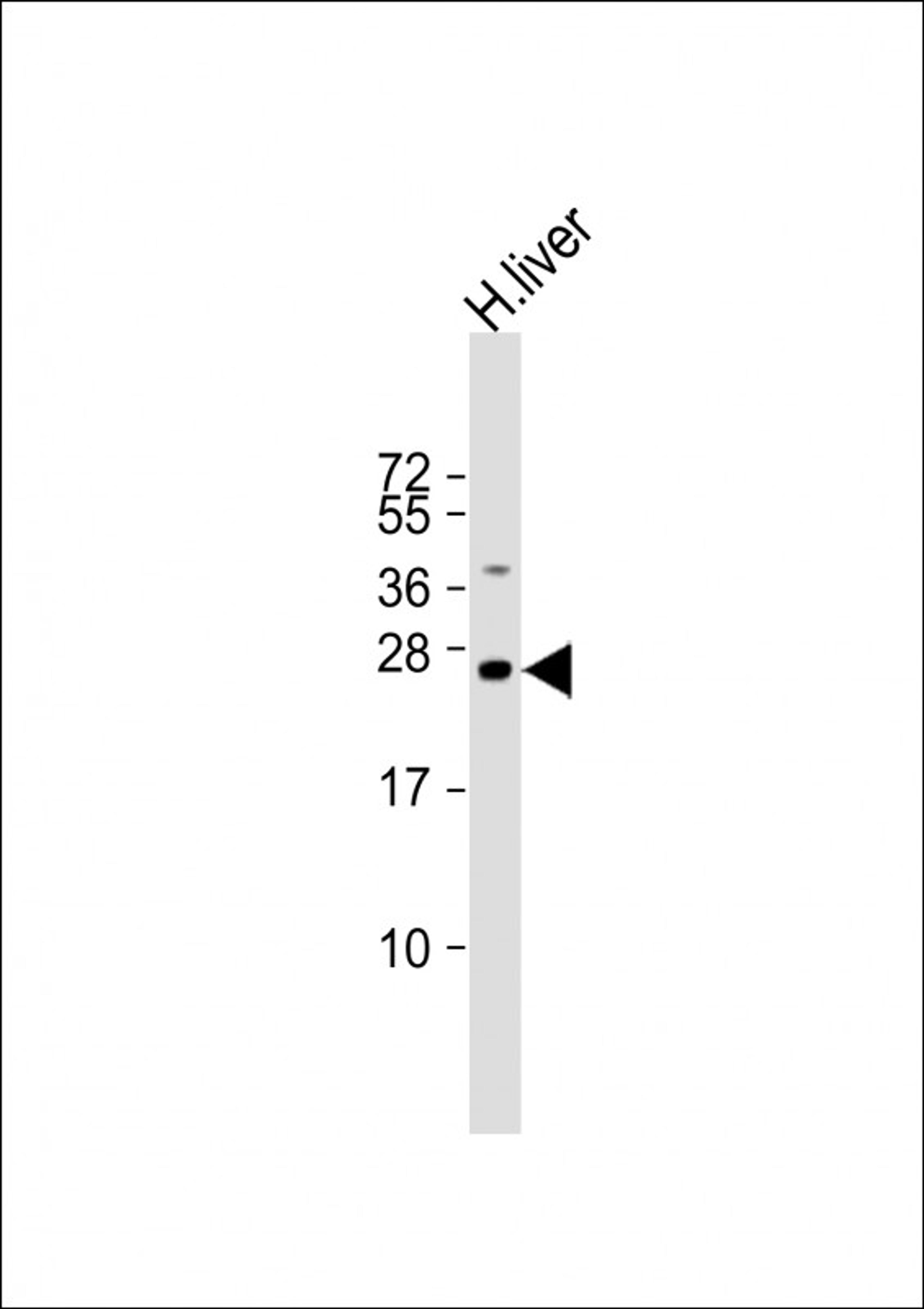 Western Blot at 1:2000 dilution + human liver lysate Lysates/proteins at 20 ug per lane.