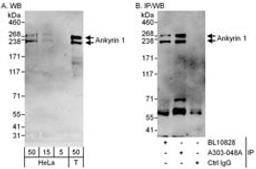 Detection of human Ankyrin 1 by western blot and immunoprecipitation.