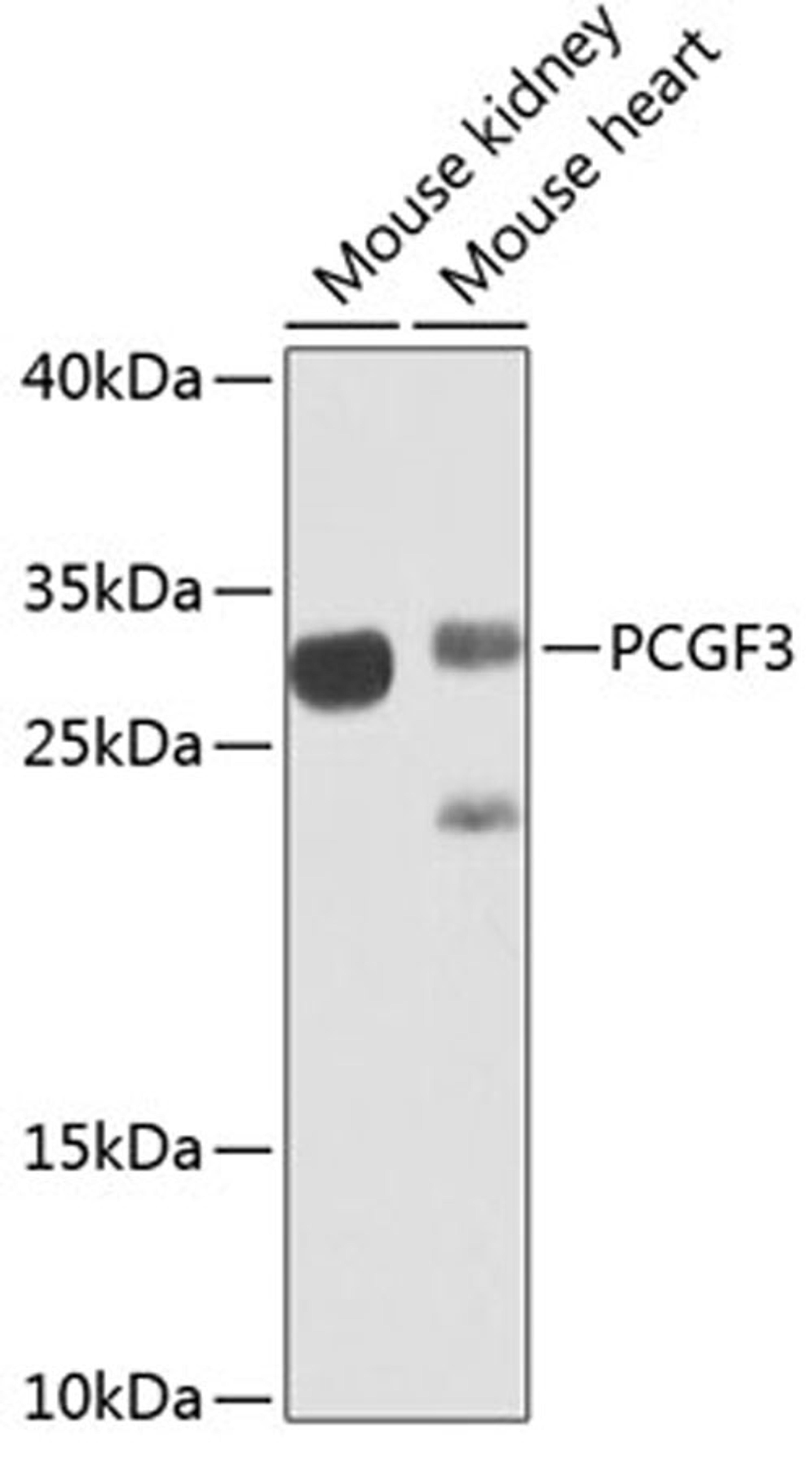 Western blot - PCGF3 antibody (A7459)