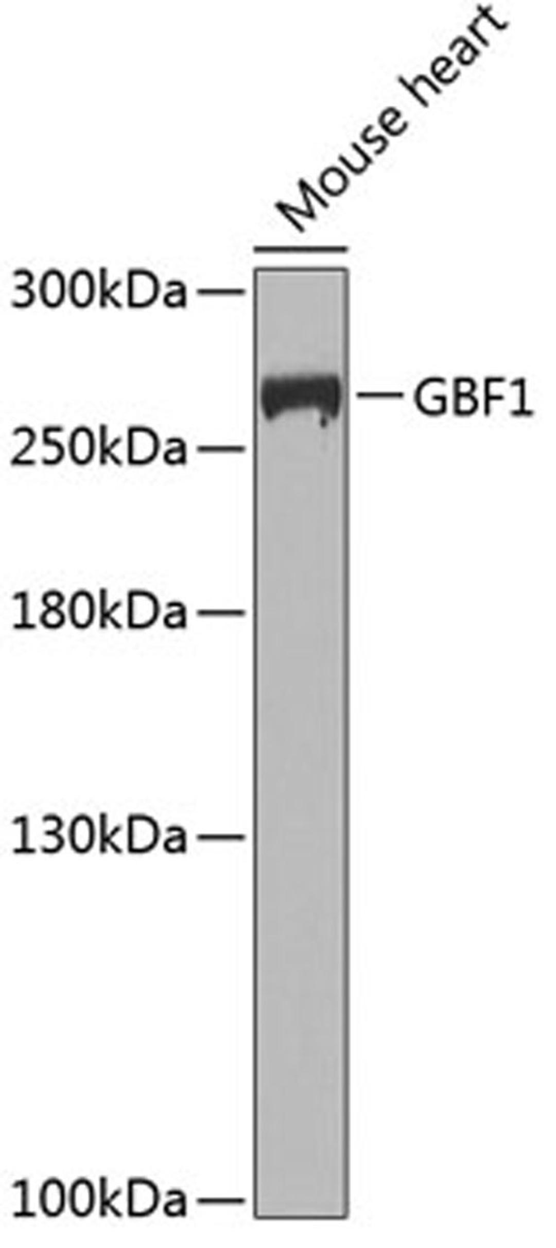 Western blot - GBF1 antibody (A8468)