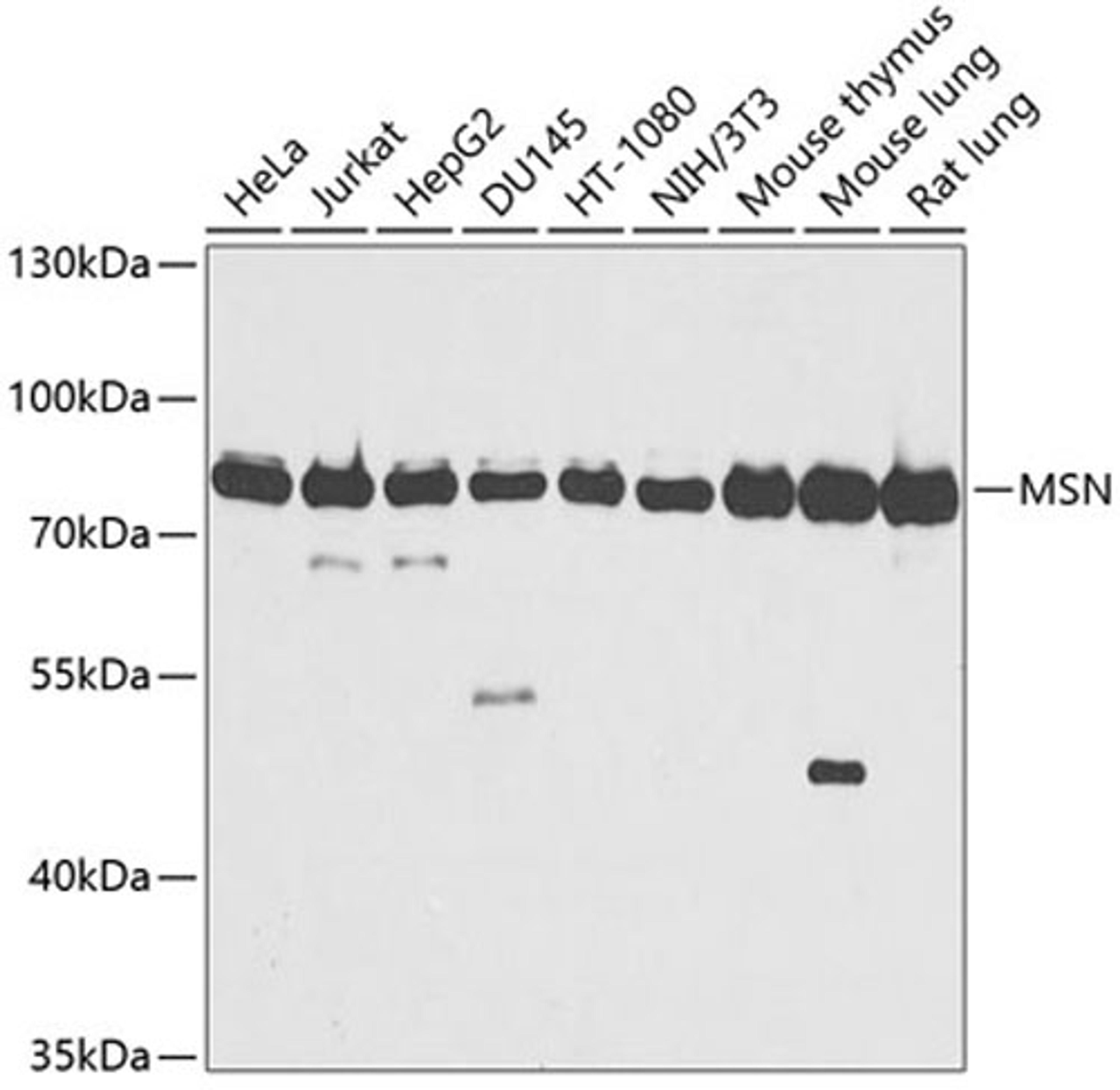 Western blot - MSN antibody (A12473)