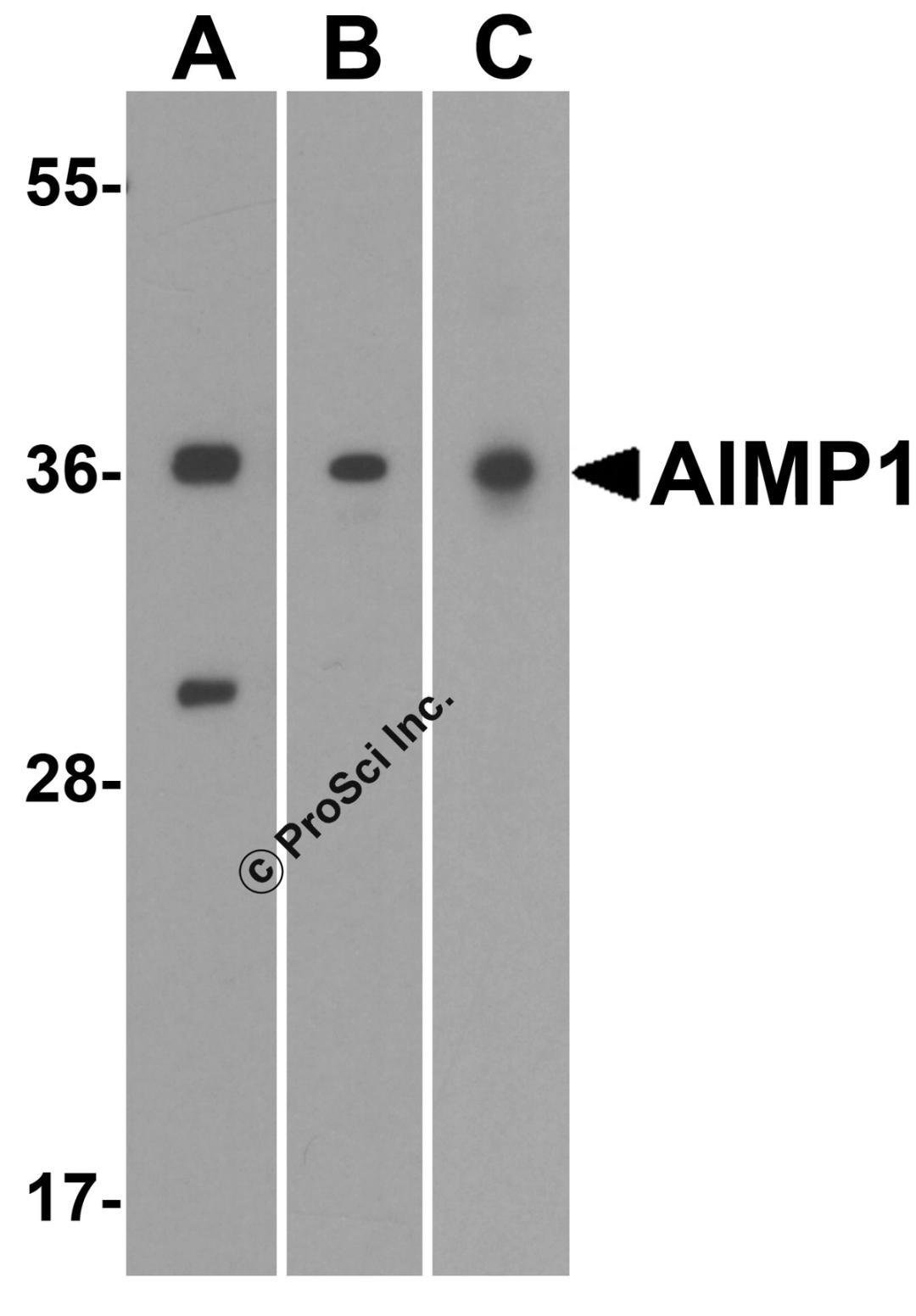 Western blot analysis of AIMP1 in (A) human, (B) mouse, and (C) rat brain tissue lysate with AIMP1 antibody at 1 μg/ml.