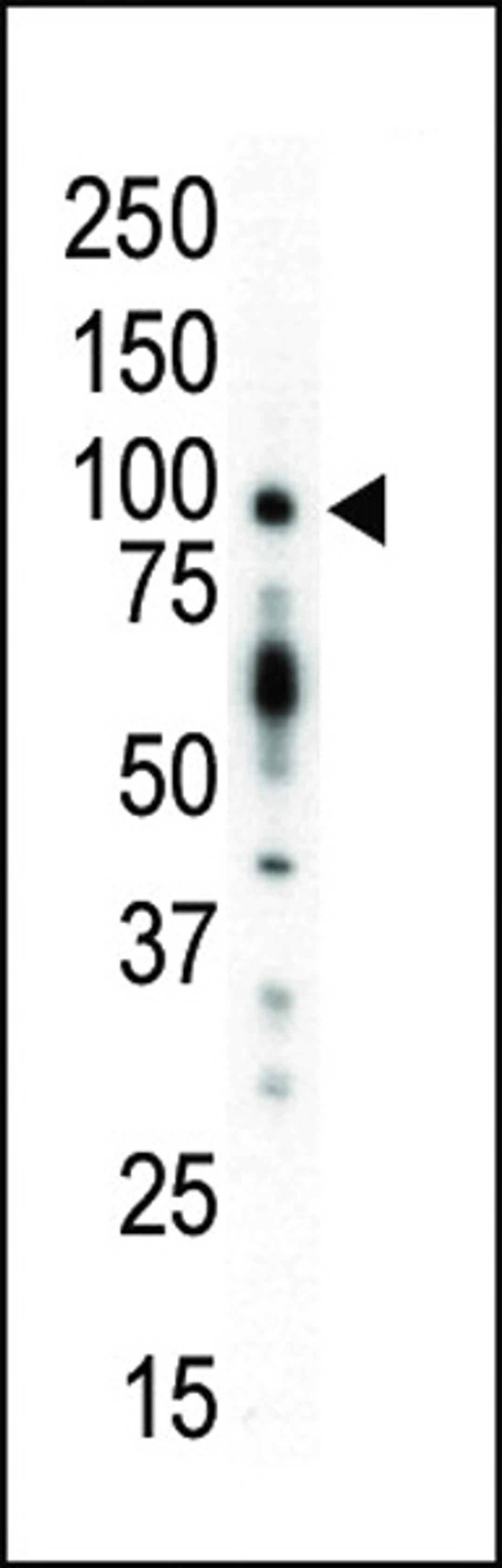 Western blot analysis of anti-PKC mu N-term Pab in mouse kidney lysate