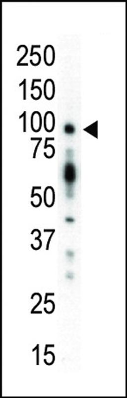 Western blot analysis of anti-PKC mu N-term Pab in mouse kidney lysate