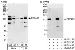 Detection of human and mouse PPP4R1 by western blot (h&m) and immunoprecipitation (h).