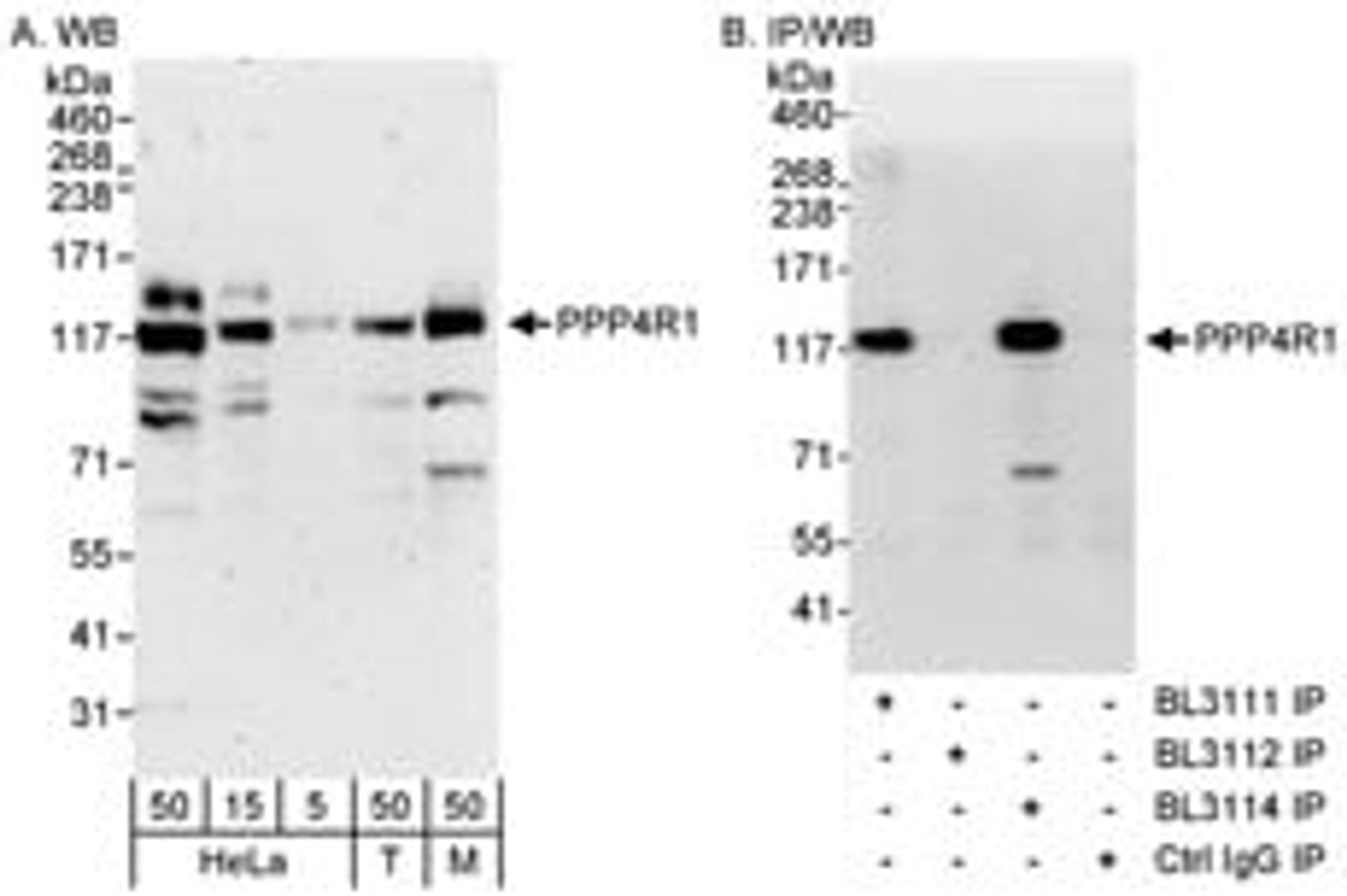 Detection of human and mouse PPP4R1 by western blot (h&m) and immunoprecipitation (h).