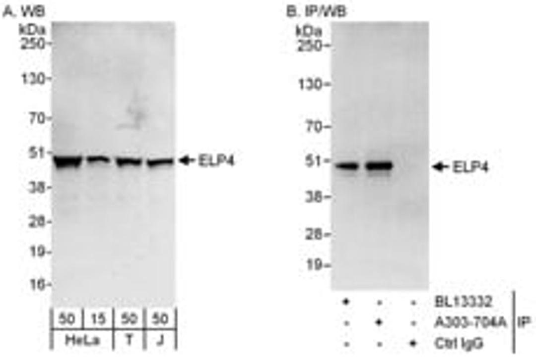 Detection of human ELP4 by western blot and immunoprecipitation.