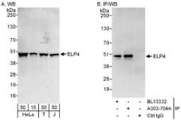 Detection of human ELP4 by western blot and immunoprecipitation.