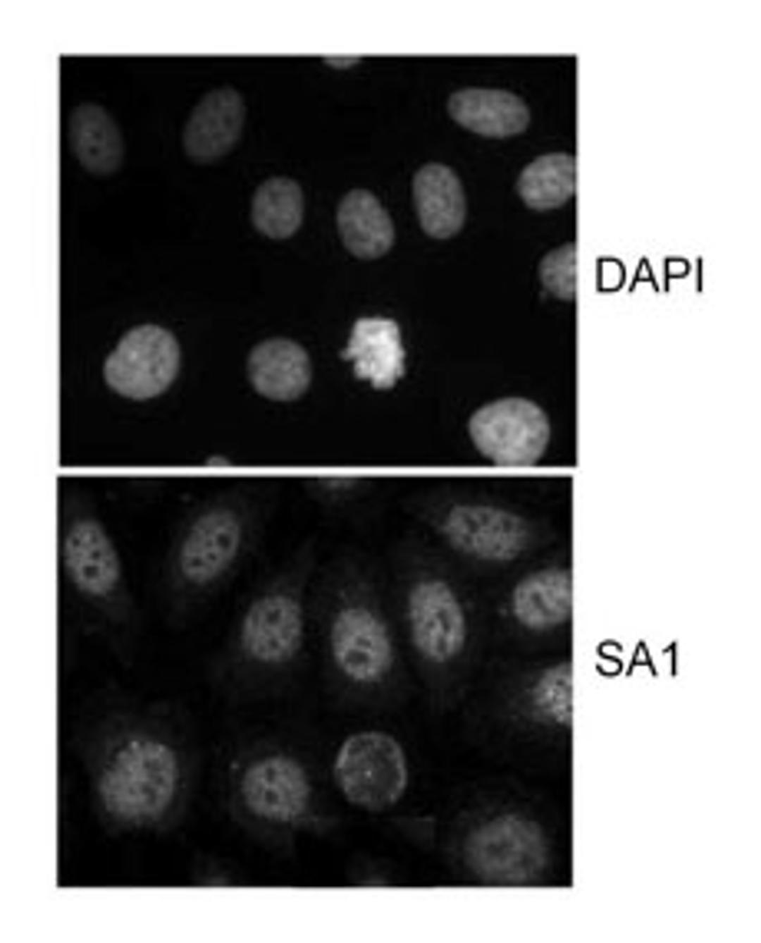 Localization of human SA1.