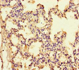 Immunohistochemistry of paraffin-embedded human lung tissue using CSB-PA011590LA01HU at dilution of 1:100