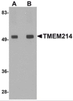 Western blot analysis of TMEM214 in rat brain tissue lysate with TMEM214 antibody at (A) 1 and (B) 2 μg/mL.