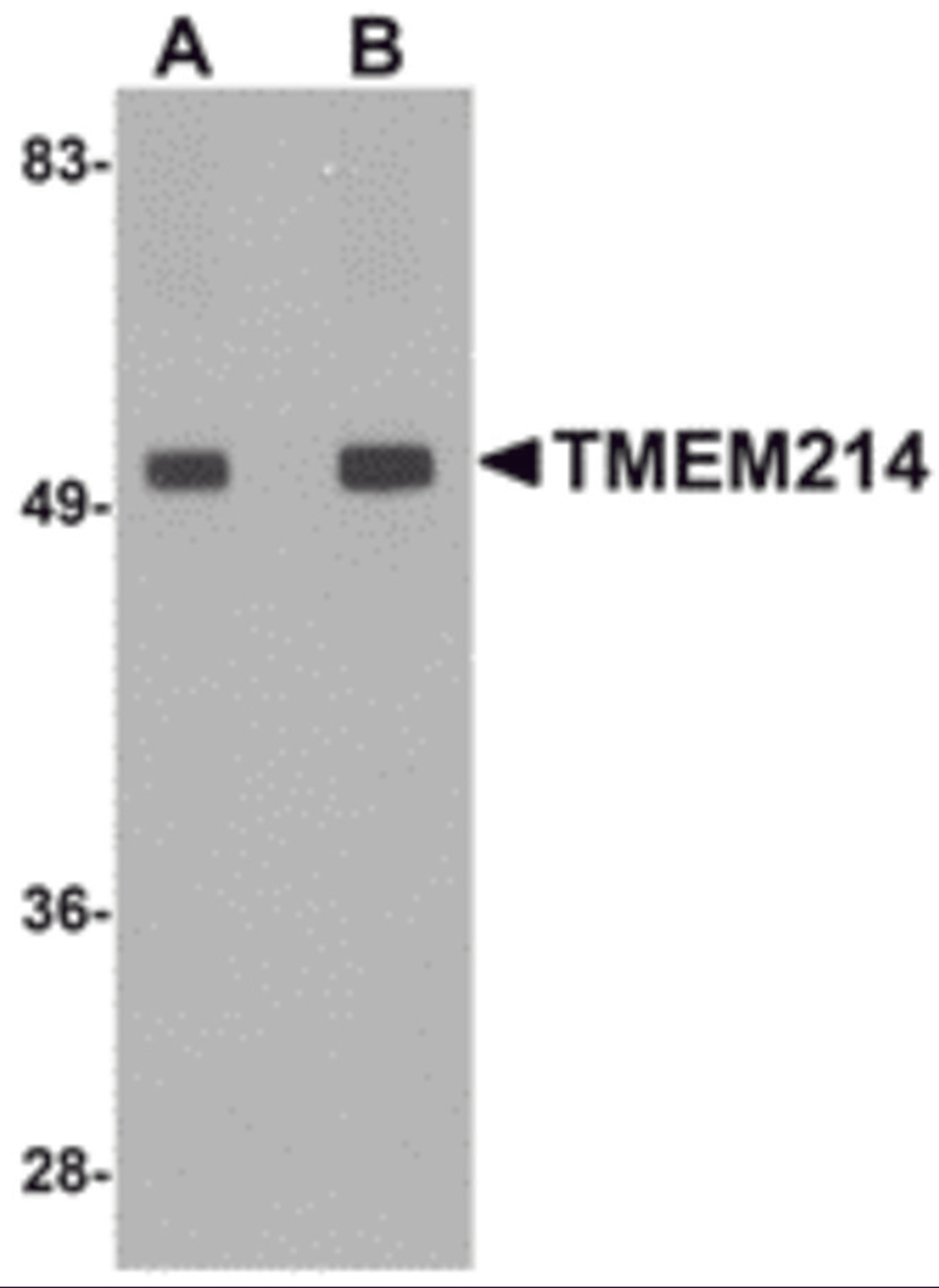 Western blot analysis of TMEM214 in rat brain tissue lysate with TMEM214 antibody at (A) 1 and (B) 2 μg/mL.